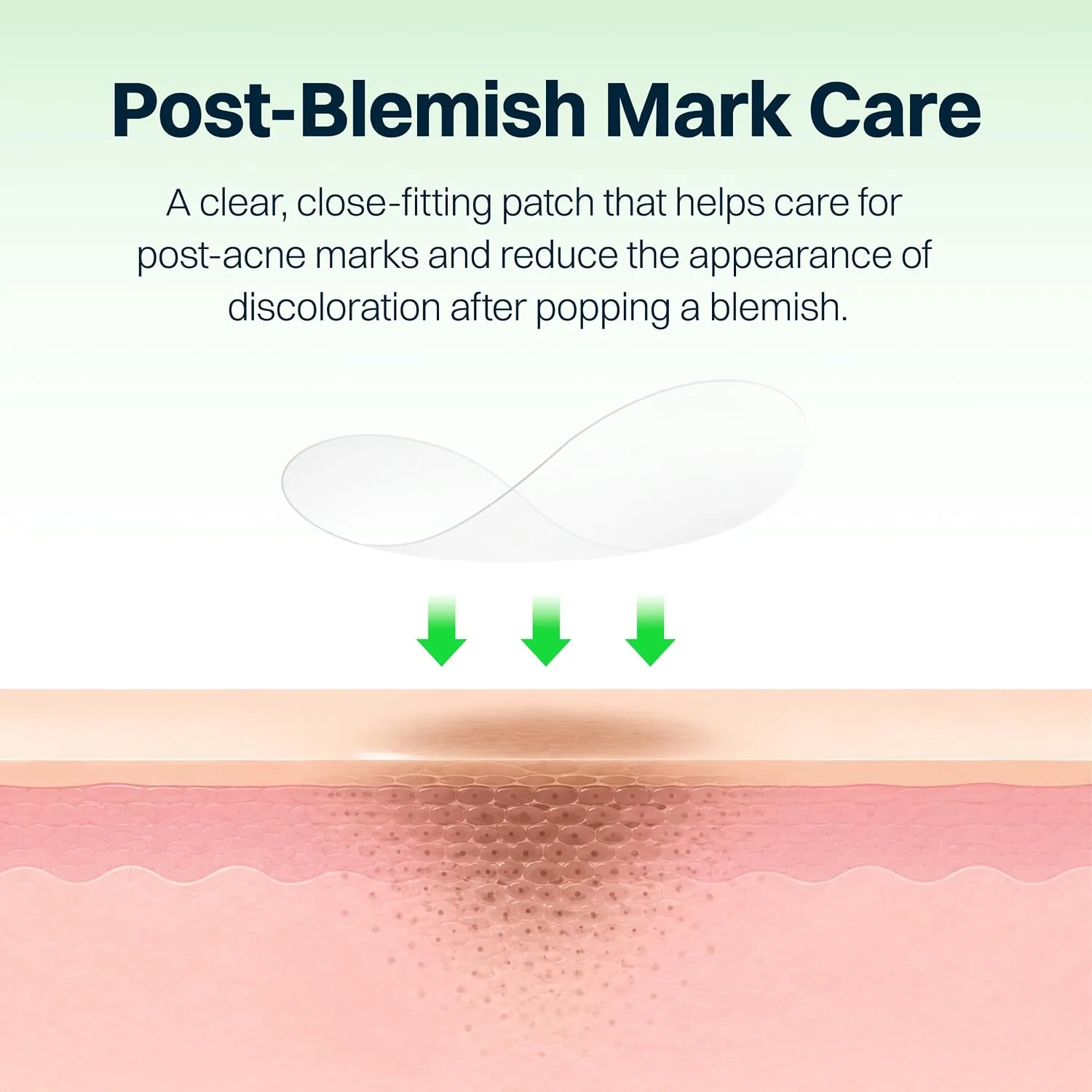 FRANZ Invisible Post-Acne Mark Patches for Dark Spots, 72 Count