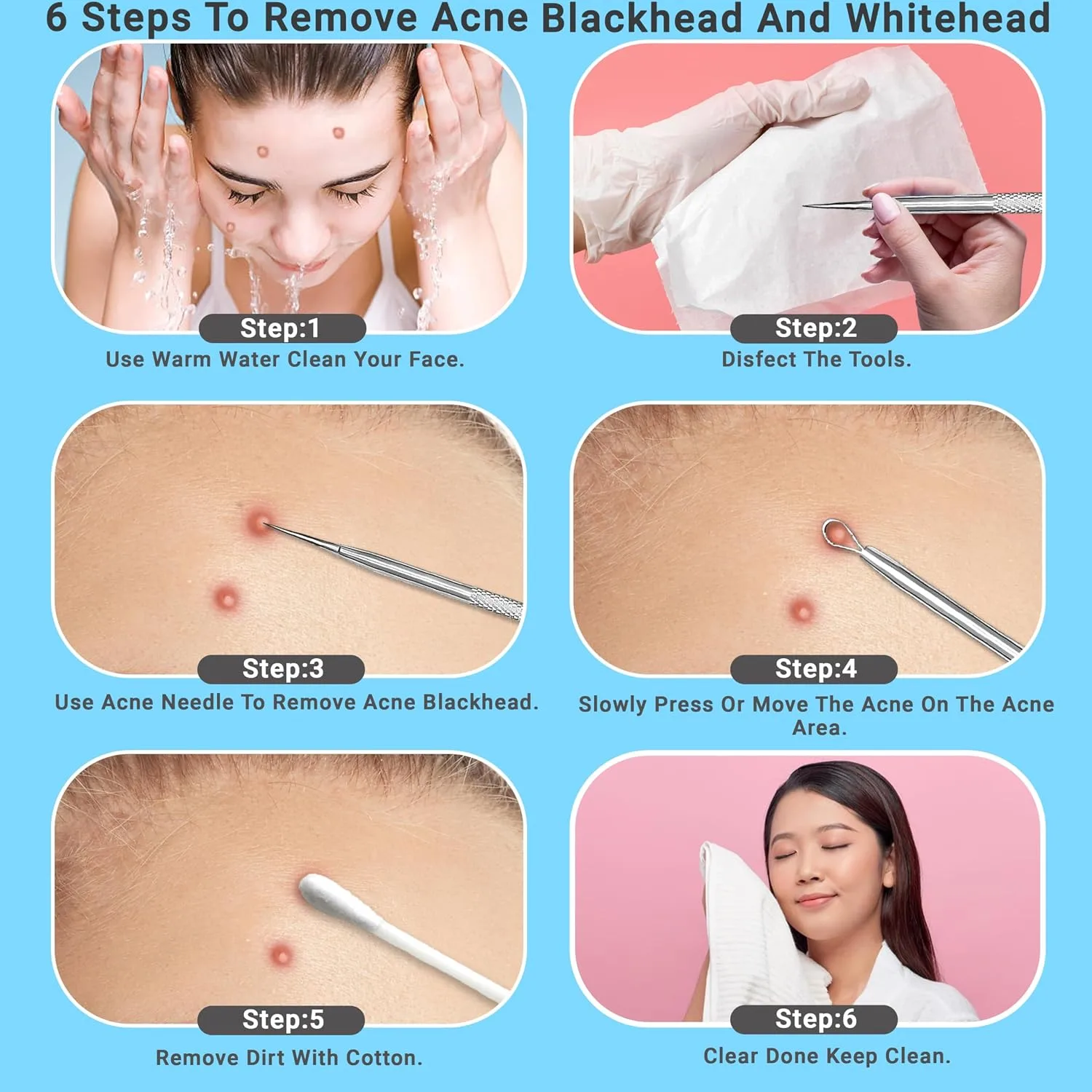 2Pcs Stainless Steel Pimple Extractor Acne Tool Surgical Blackhead Remover