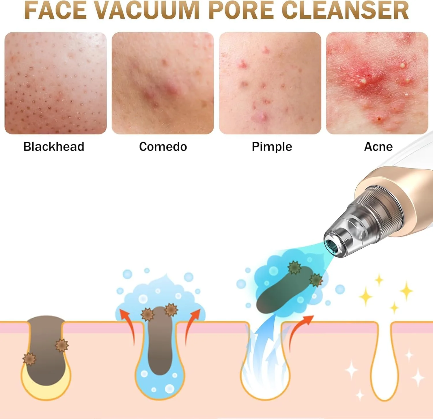 Blackhead Remover Tools,Electric Vacuum Facial Pore Cleaner Tool (Golden)