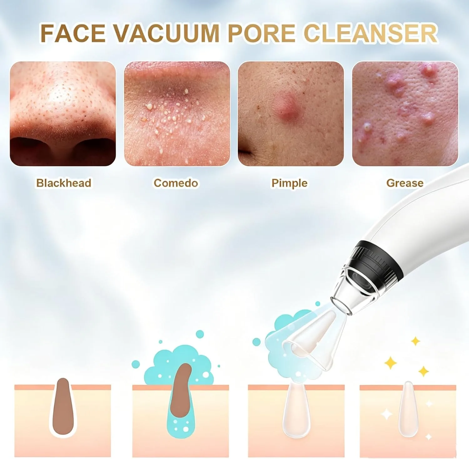 Blackhead Remover Tools,Electric Vacuum Facial Pore Cleaner Tool(White)