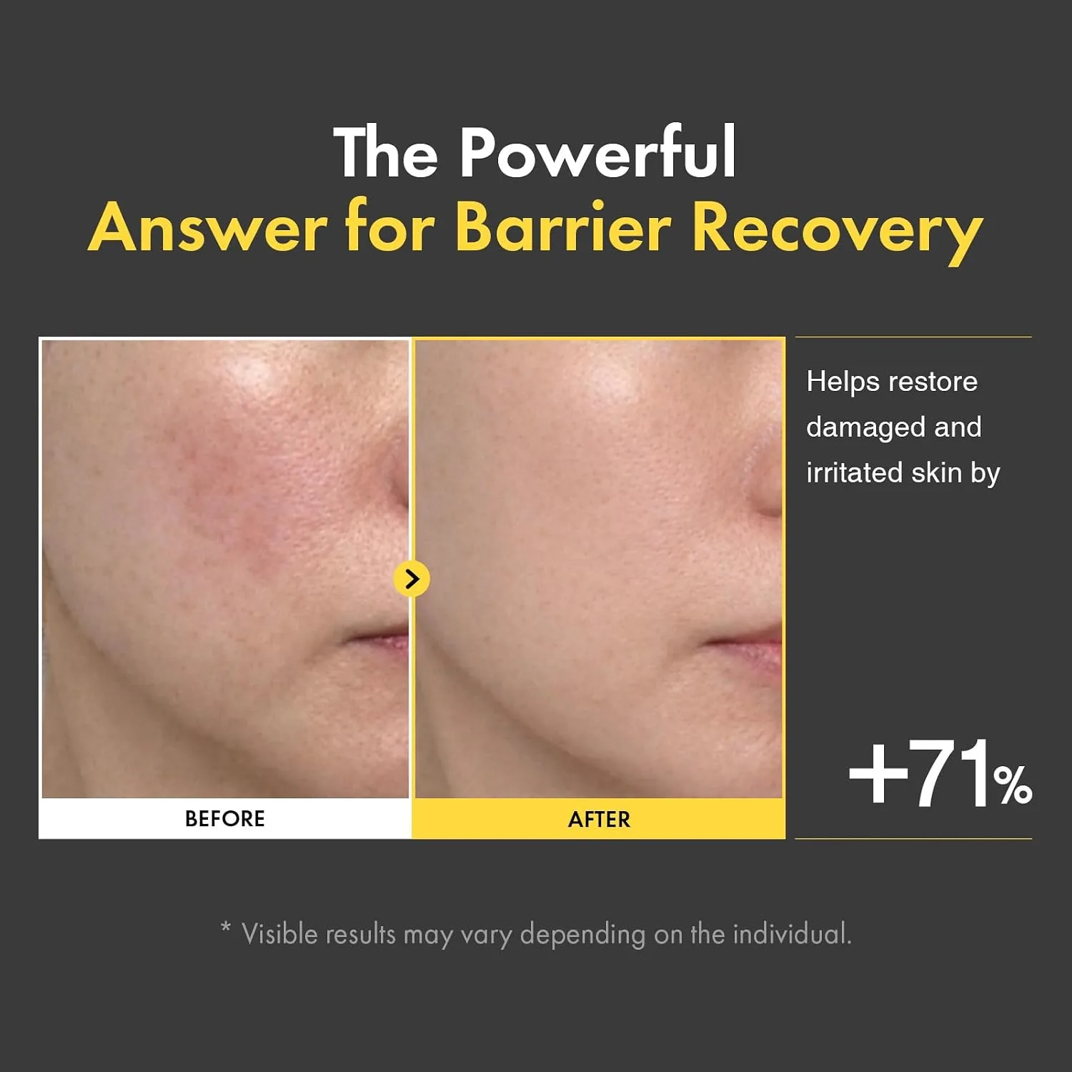 TOSOWOONG Ceramide Barrier Cream for Dry & Sensitive Skin, Hydrating, Dewy