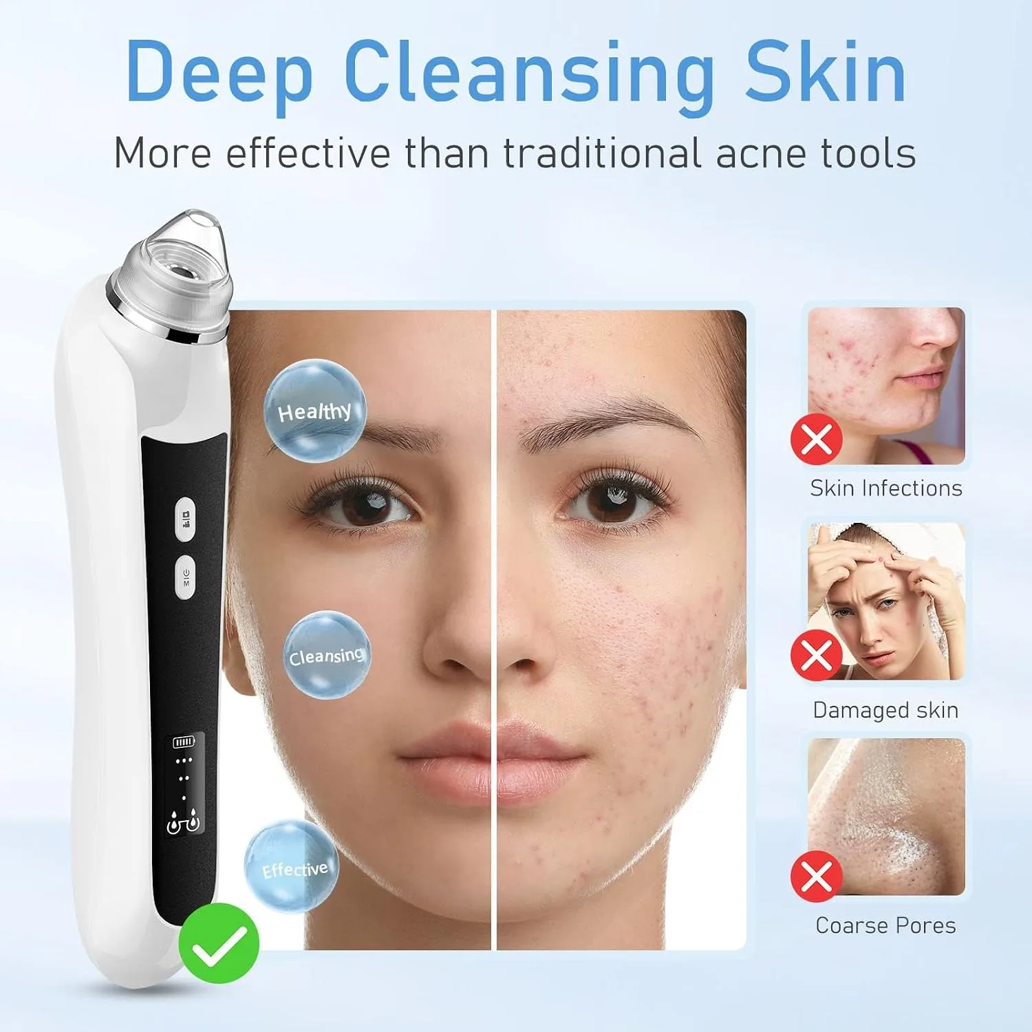 HD Camera USB Blackhead Remover, 3 Modes 6 Heads for Men Women(Deep Black)