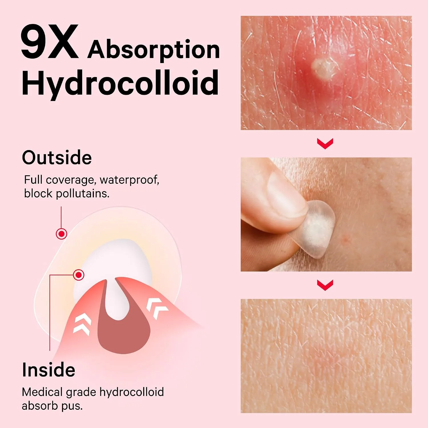 Sosky Pimple Patches for Face, Invisible Hydrocolloid Acne Patches, HSA Store Eligible Items, Zit Sticker for Face and Skin, Pimple Sticker for Covering Zits, Blemishes with Salicylic Acid 48 Count
