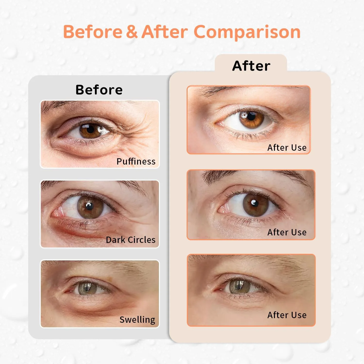 4PCS Gel Eye Ice Pack Set Reusable, Cold and Hot Compress for Eyes