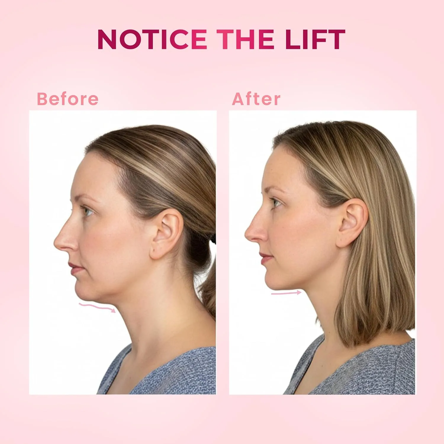 V-Line Chin Up Mask – V Shaped Face lift mask for Double Chin Reducer, Jawline Shaper Chin Strap for Sleeping Adjustable Face Slimmer for Women