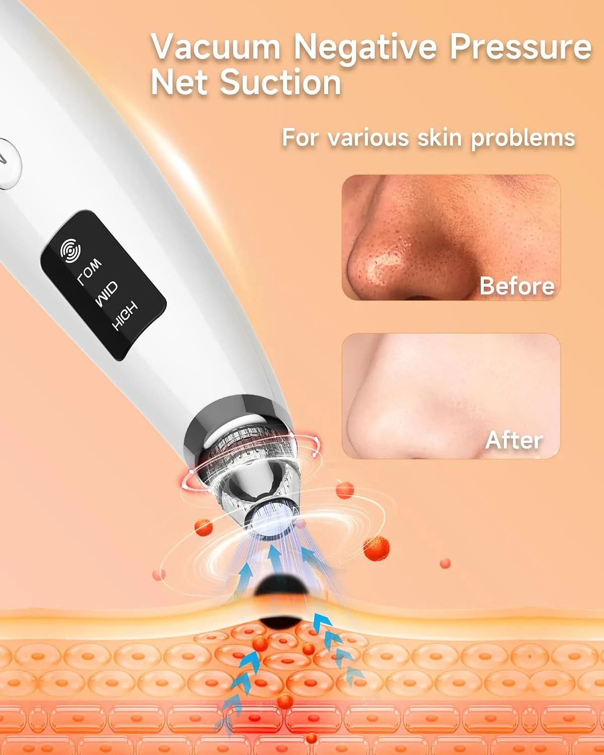 Blackhead Remover Vacuum, Type-C Rechargeable Pore Cleaner with 3 Adjustable Suction, 6 Probes & Comedone Extractor Tool Kit for Women and Men, White Heads Removal for Face & Nose (White)