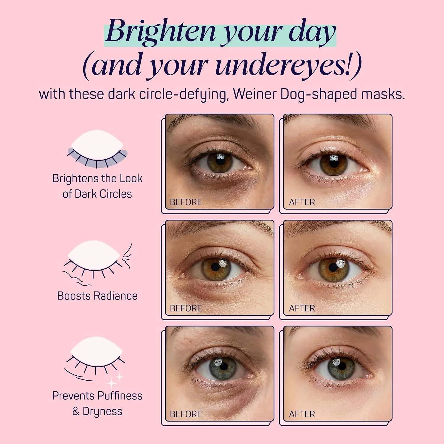 SpaLife So Fetch Hydrogel Under Eye Patches for Dark Circles | Dachshund Under Eye Patches for Puffy Eyes | Weiner Dog Undereye Bags and Puffiness Removal | Boo Basket Stuffers | 8 Pairs