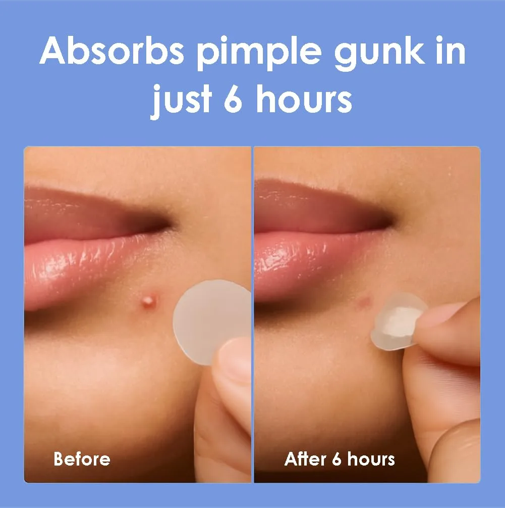 1250 Count Pimple Patches for Face, Cut to Size Hydrocolloid Roll Tape