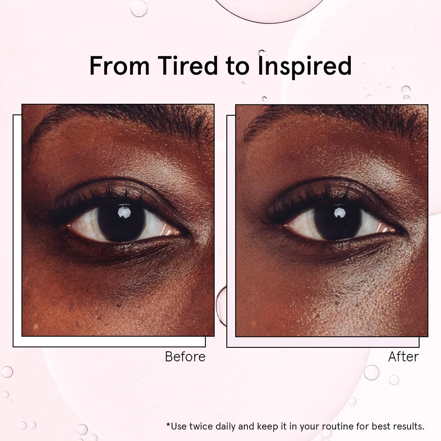 grace & stella Under Eye Serum Roller with Cooling Metal Ball (15ml)
