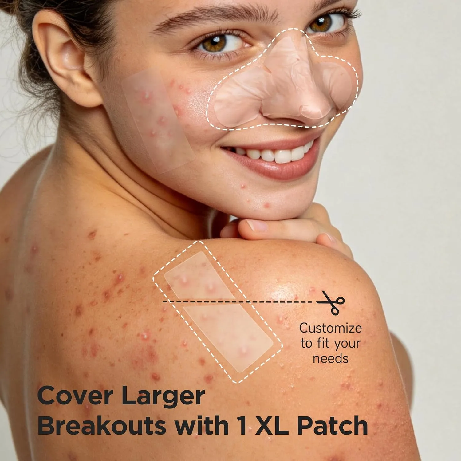 Large Hydrocolloid Pimple Patches for Breakout Areas, 30 Count
