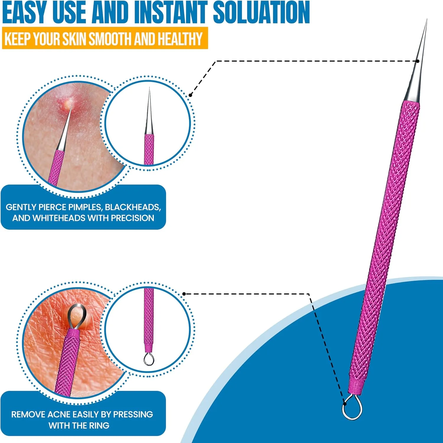 2Pcs Stainless Steel Pimple Extractor Acne Tool Surgical Blackhead Remover