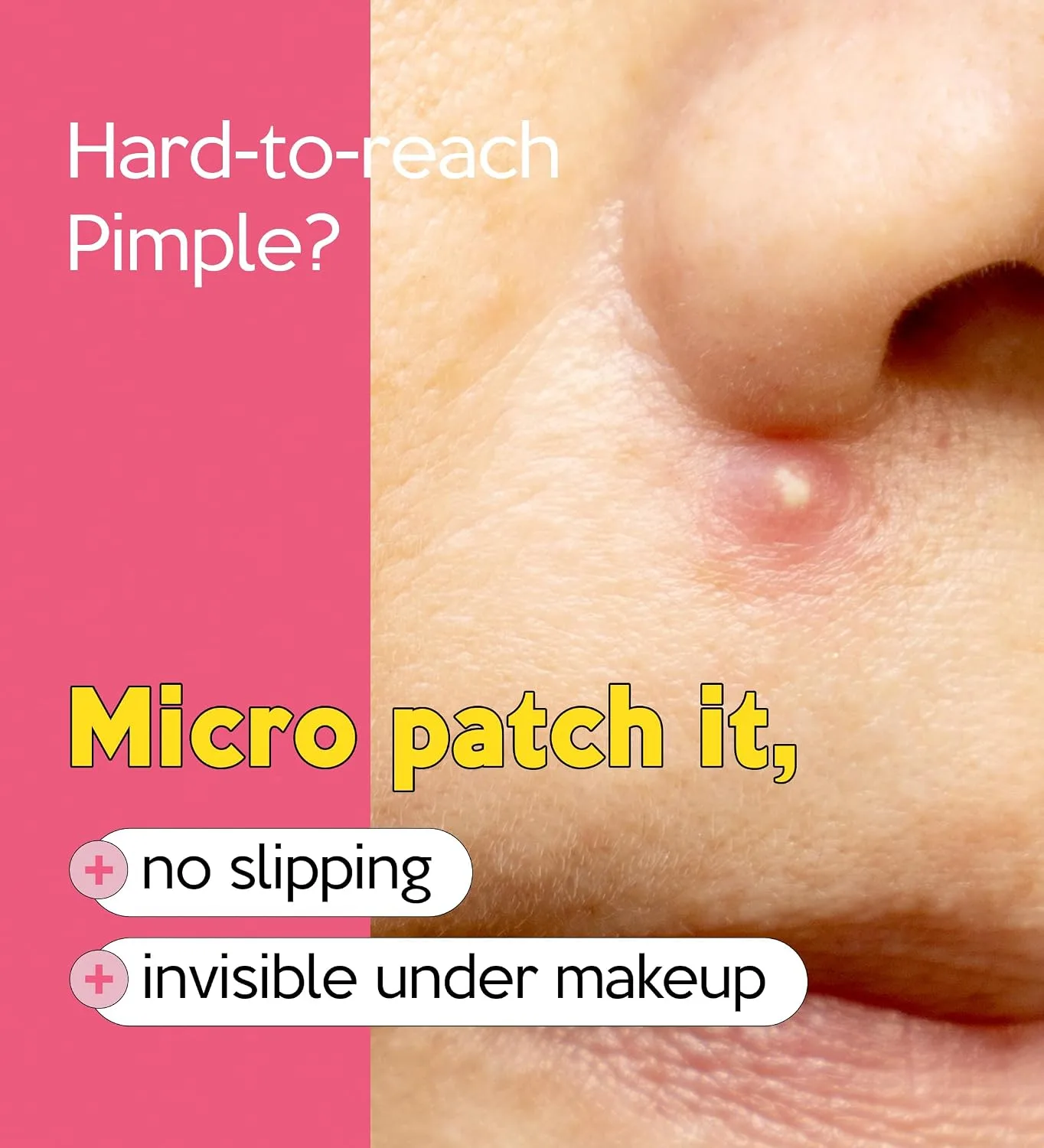 Troubless Invisible Plus Spot Patch - Hydrocolloid (0.8cm & 1cm, 123 EA)