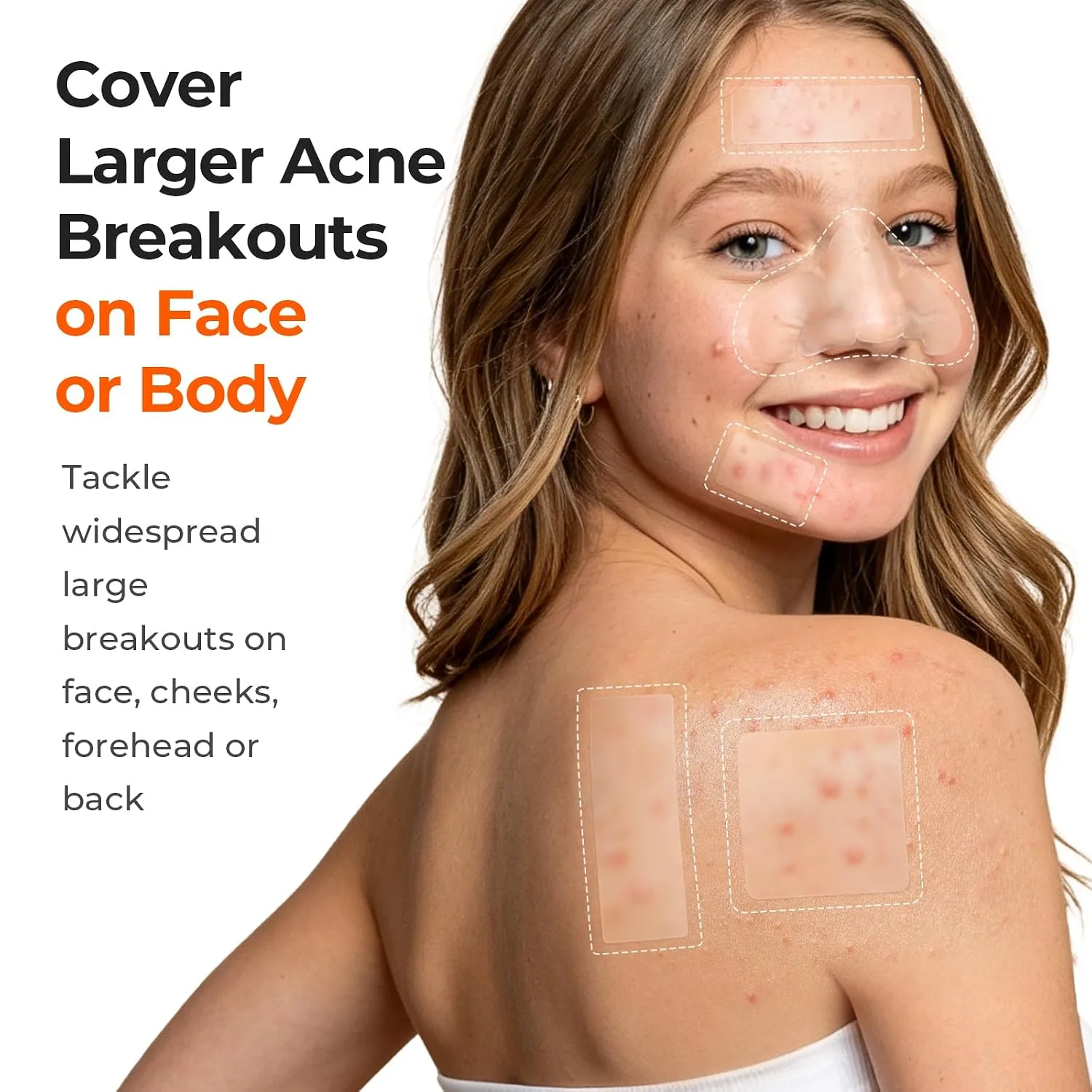 TKTK Large Hydrocolloid Pimple Patches for Acne Breakouts, 4 Big Sizes