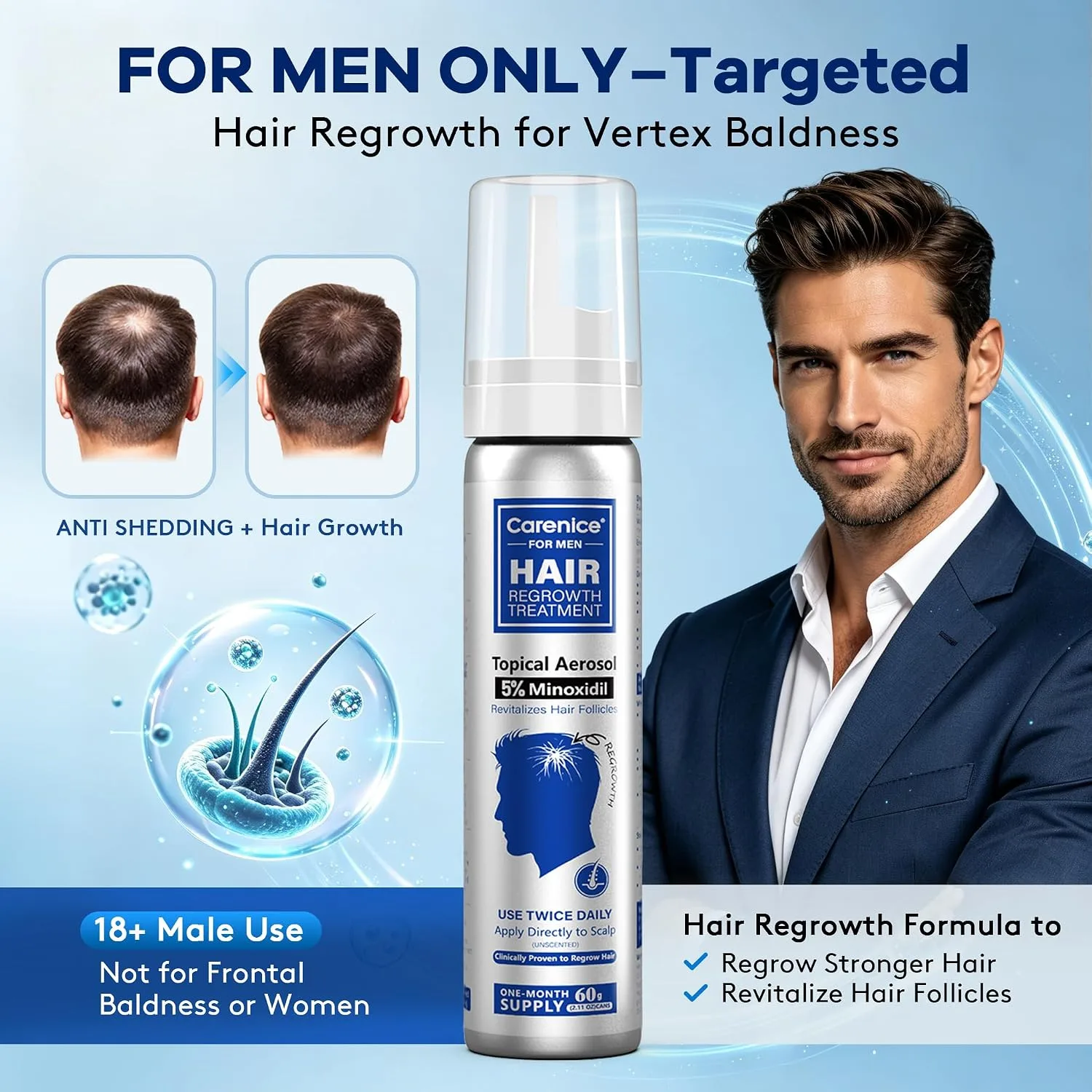 Men's 5% Topical Minoxidil Aerosol Foam Unscented, Biotin Infused Hair Beard Growth Treatment for Thicker Fuller Hair, Comparable to Rogaine Active Ingredient, 8.44oz 4 Month Supply