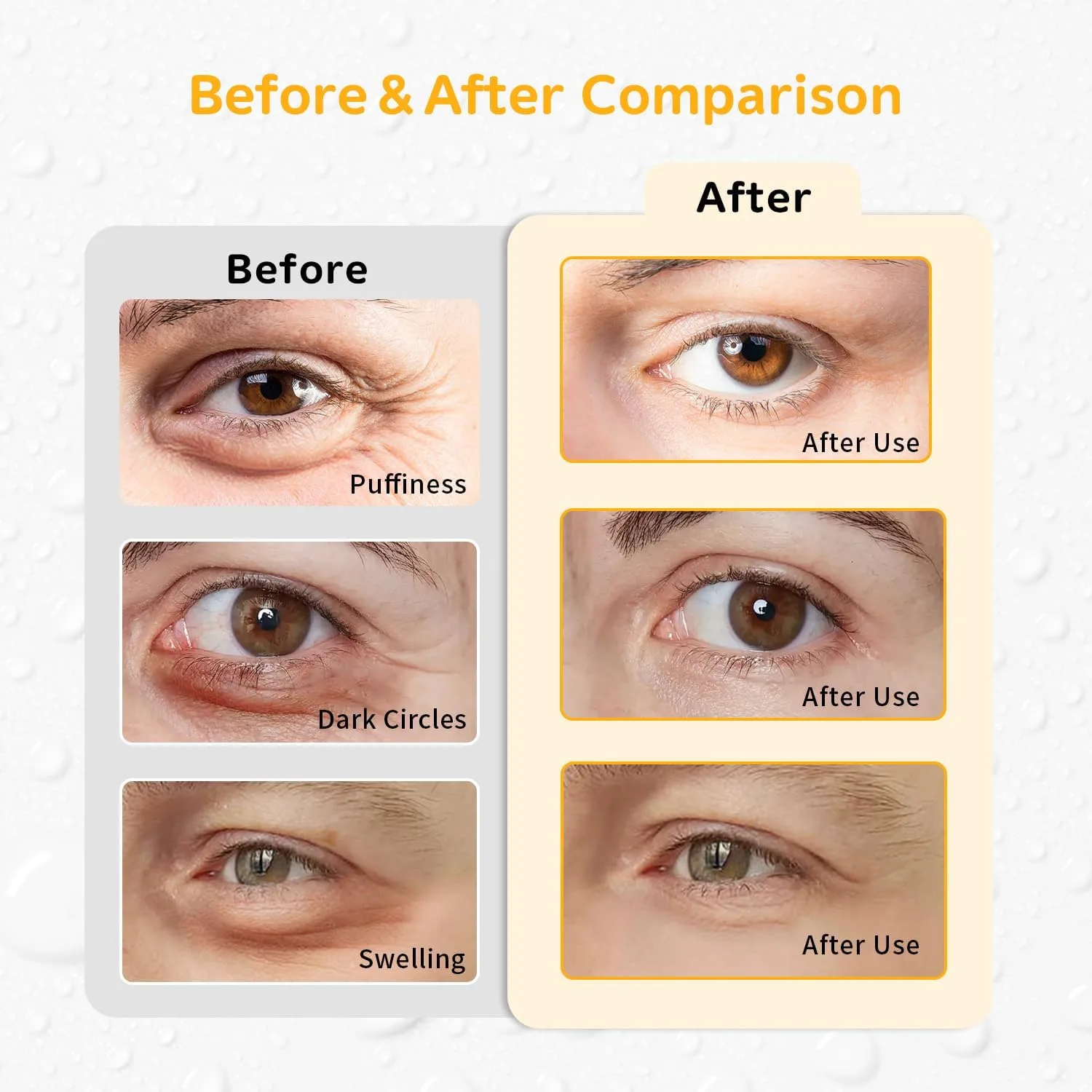 4PCS Gel Eye Ice Pack Set Reusable, Cold and Hot Compress for Eyes