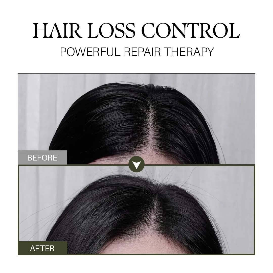 d'alba Piedmont Professional Repairing Scalp Therapy Serum Shampoo 275ml, Mild and Vegan Formula, Gentle Hair and Scap Treatment
