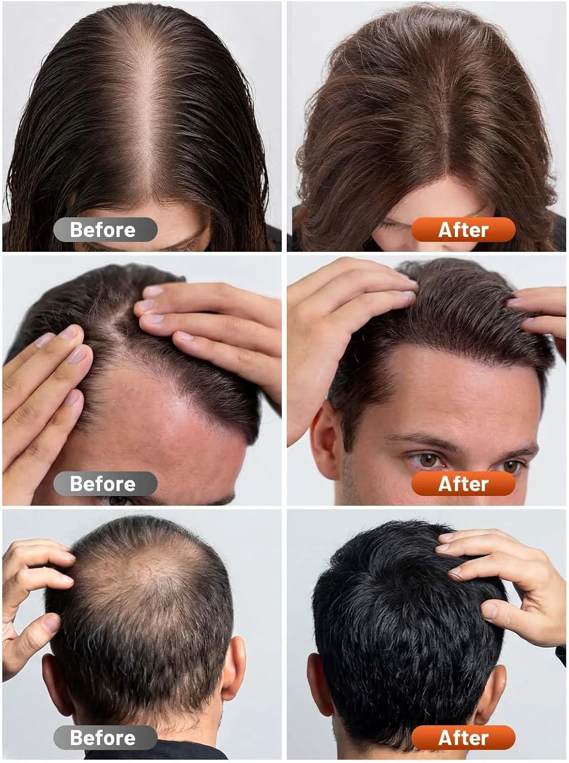 RELEXNOW Red Light Therapy Cap for Hair with Upgraded 180 Tri-Chip LEDs