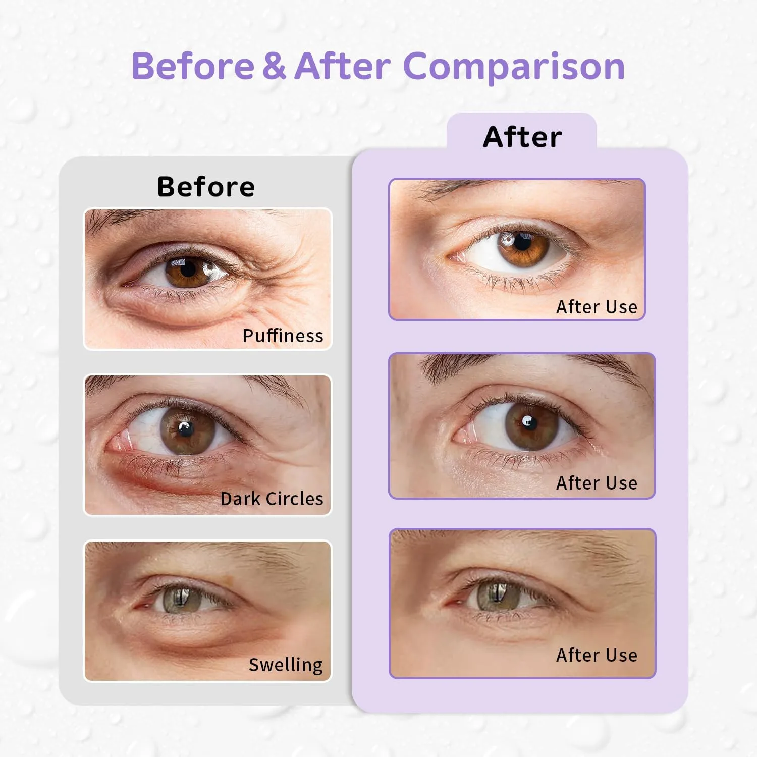 4PCS Gel Eye Ice Pack Set Reusable, Cold and Hot Compress for Eyes