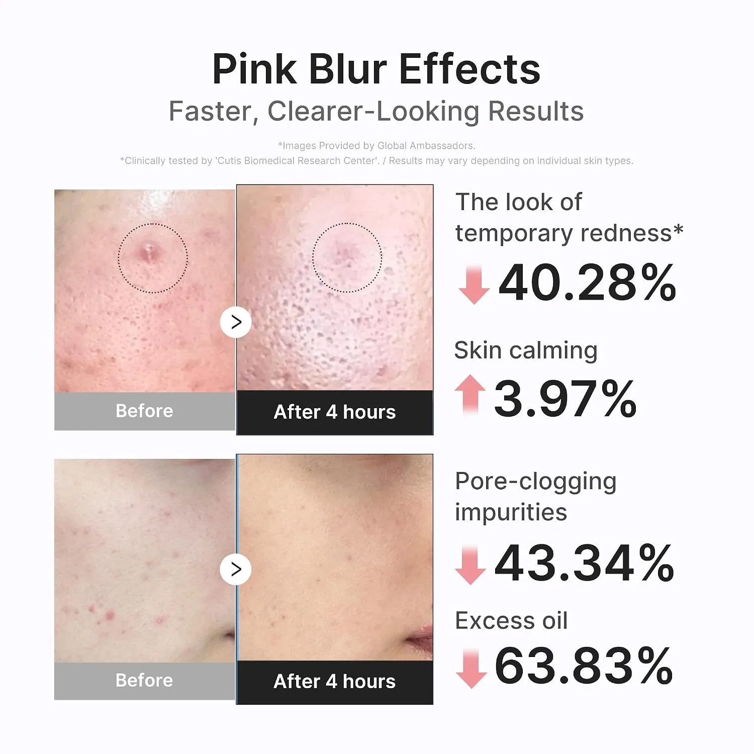 medicube 3H Overnight Drying Lotion for Targeted Spot Care