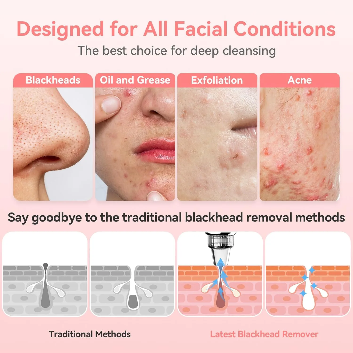 Blackhead Remover Pore Vacuum, USB Rechargeable Face Pore Cleaner Tool