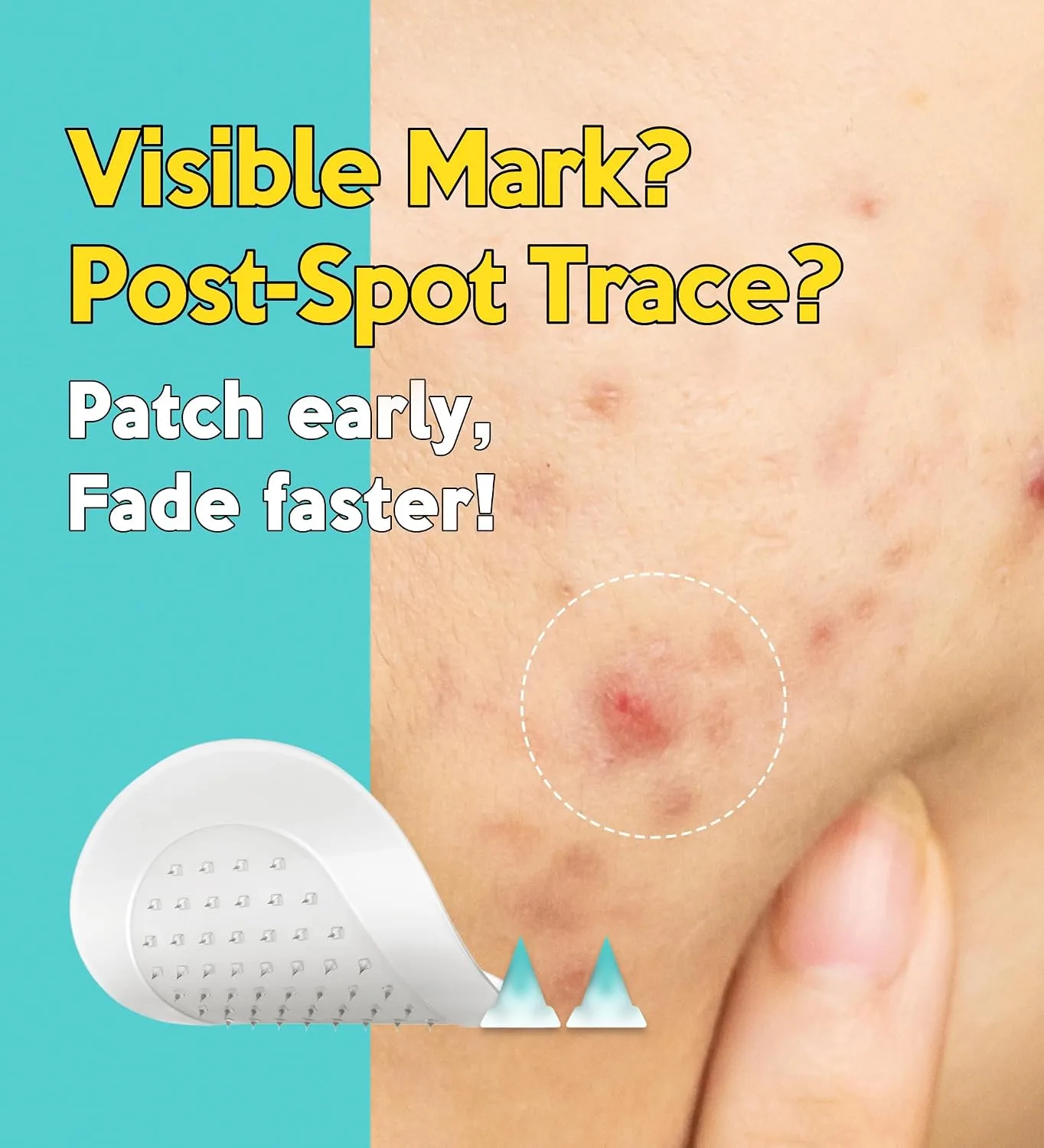 Troubless Micro Patch Plus - 10% Vitamin C Zit Hydrocolloid Patch 9EA