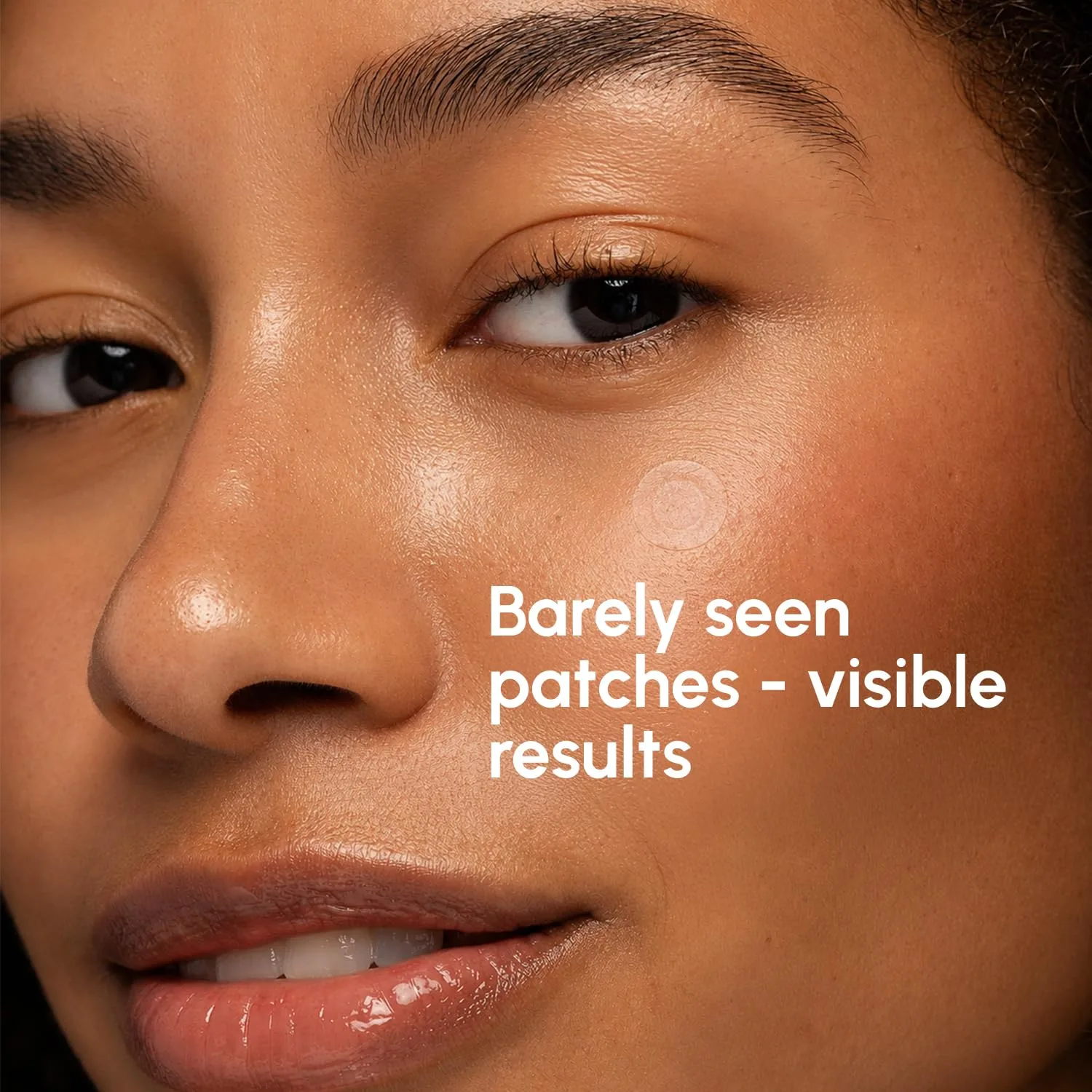 MAREE Invisible Pimple Patches for Face - Clear Zit Acne Patches - 72 Ct