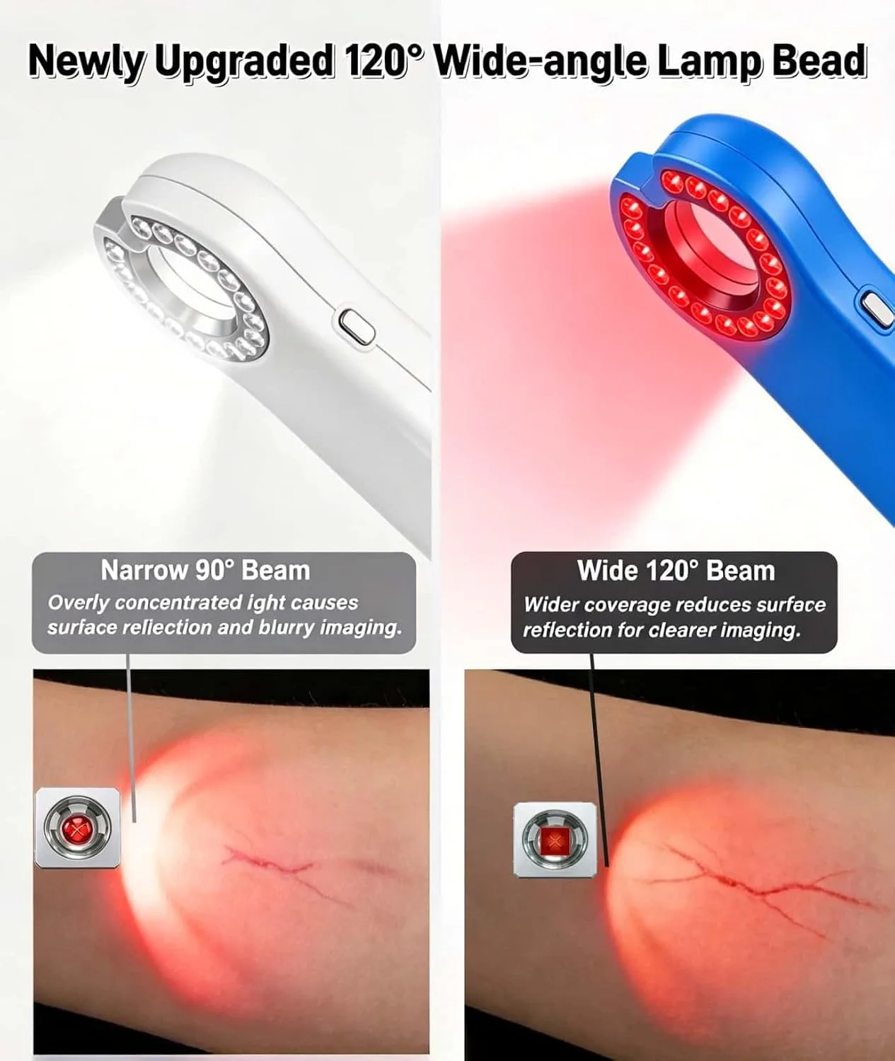 Vein
Finder
Viewer,
99
Levels
for
Different
Skin
Tones