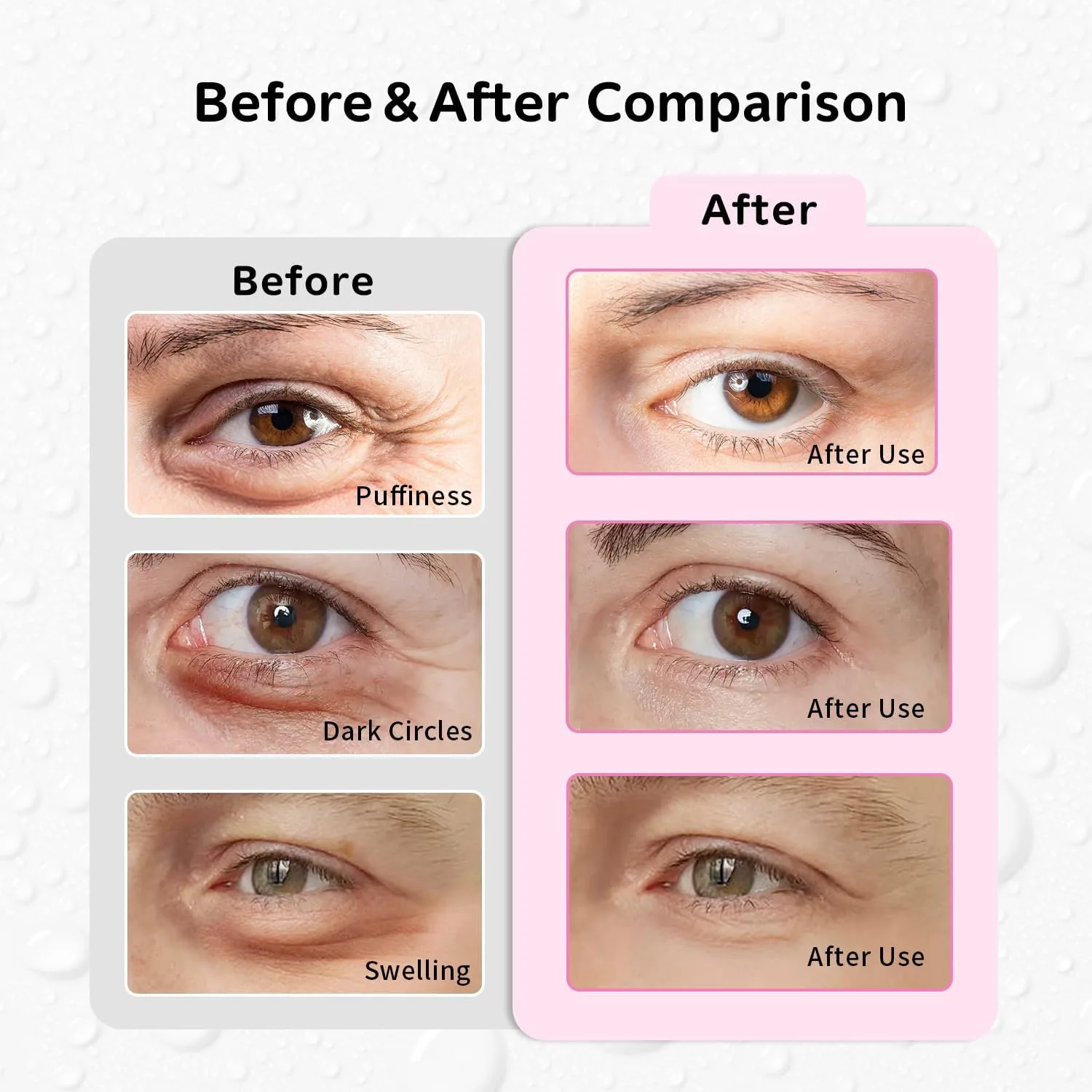 Hot and Cold Eye Pads, Reusable Eye Patches