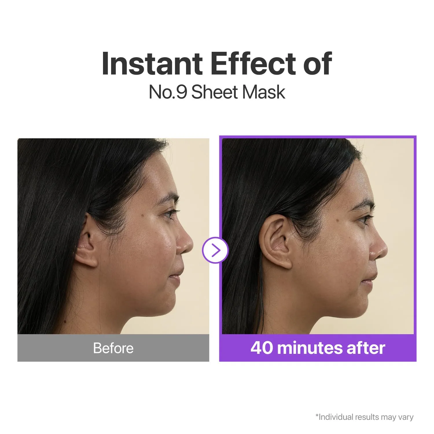 numbuzin No.9+ NAD+ BIO Lifting Full Face Mask, Peptide & Collagen Two-Piece Firming Mask for a Smooth, Defined-Looking Skin Finish, 4 Sheets + Lifting Band (Pack of 3)