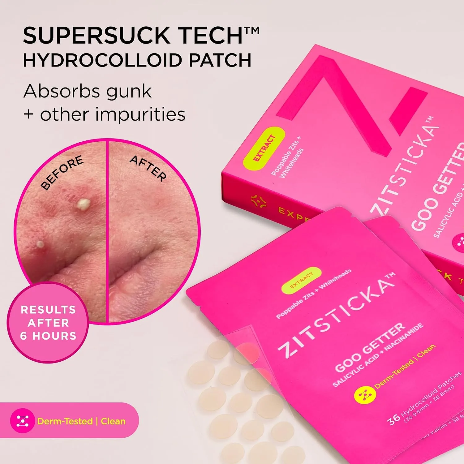 ZitSticka Pimple Patches for Face, Hydrocolloid Acne Patches, 36 Count