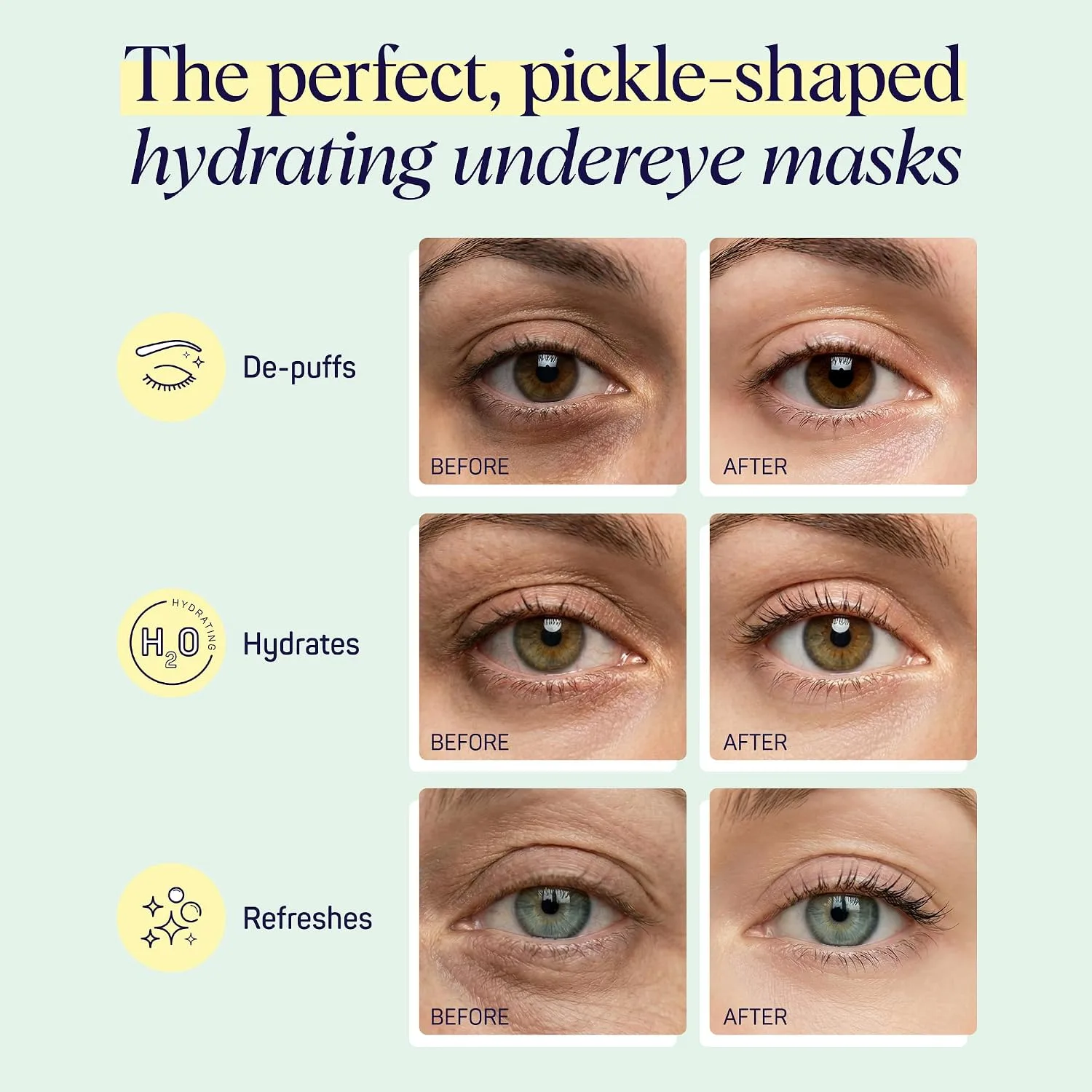 SpaLife In a Pickle Hydrogel Under Eye Patches for Dark Circles | Pickle Gifts for Women | Hydrating Undereye Masks for Bags and Puffiness | Pack of 8 Pairs (8 Undereye Treatments)