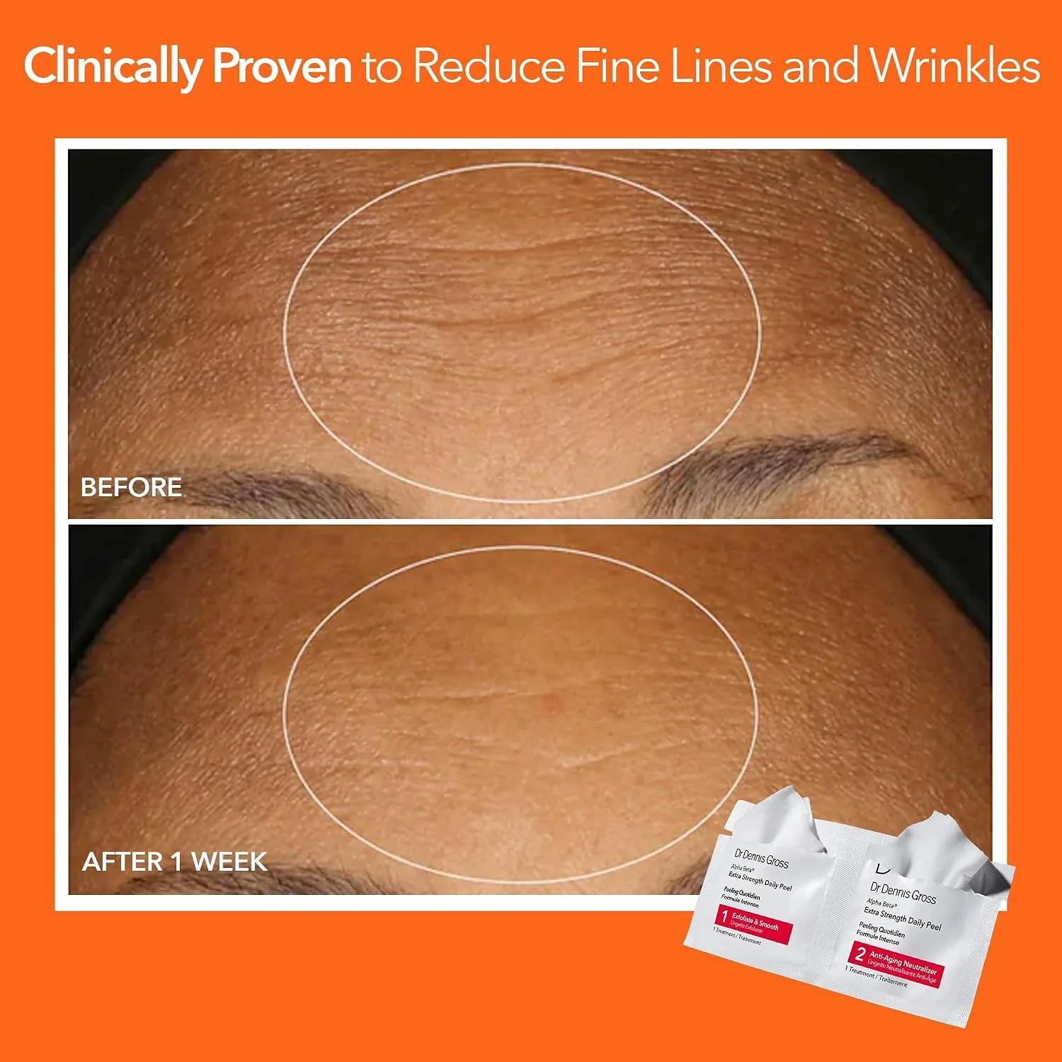 Dr Dennis Gross Alpha Beta Extra Strength Exfoliating Daily Peel - 60 Pack