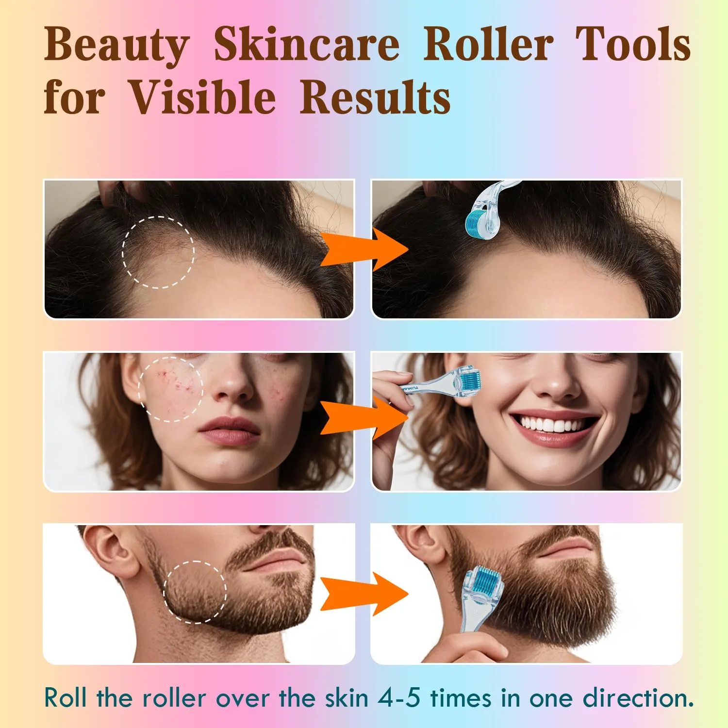 Derma Roller - TUMAKOU Microneedling Microneedle Roller for Face Scalp Hair
