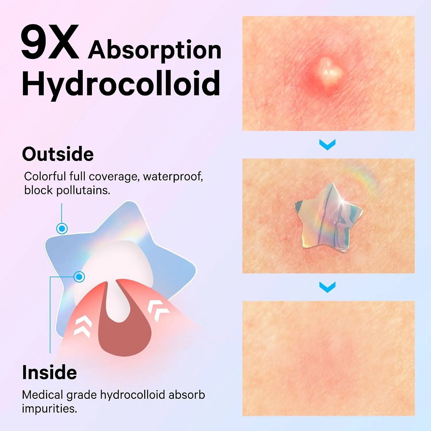 Sosky Holographic Star Pimple Patches, Hydrocolloid Acne Patches, 144 Count Blue Pink Star Heart Moon Cloud Butterfly Flower