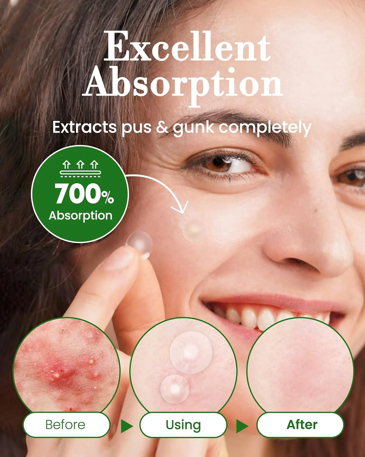 Troubless Invisible Pimple Spot Patch - 96 Ultra Thin Acne Patches - Easy Peel - 2 Sizes