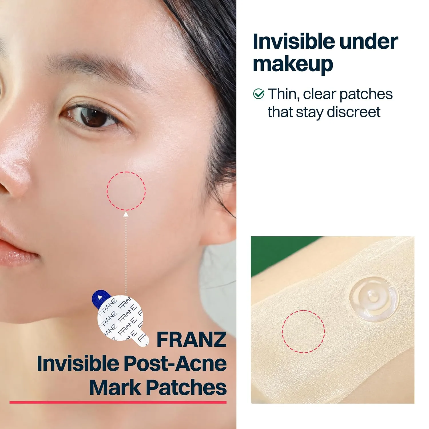 FRANZ Blind Pimple Patches for Early Breakouts, Invisible Dots (72 Count)