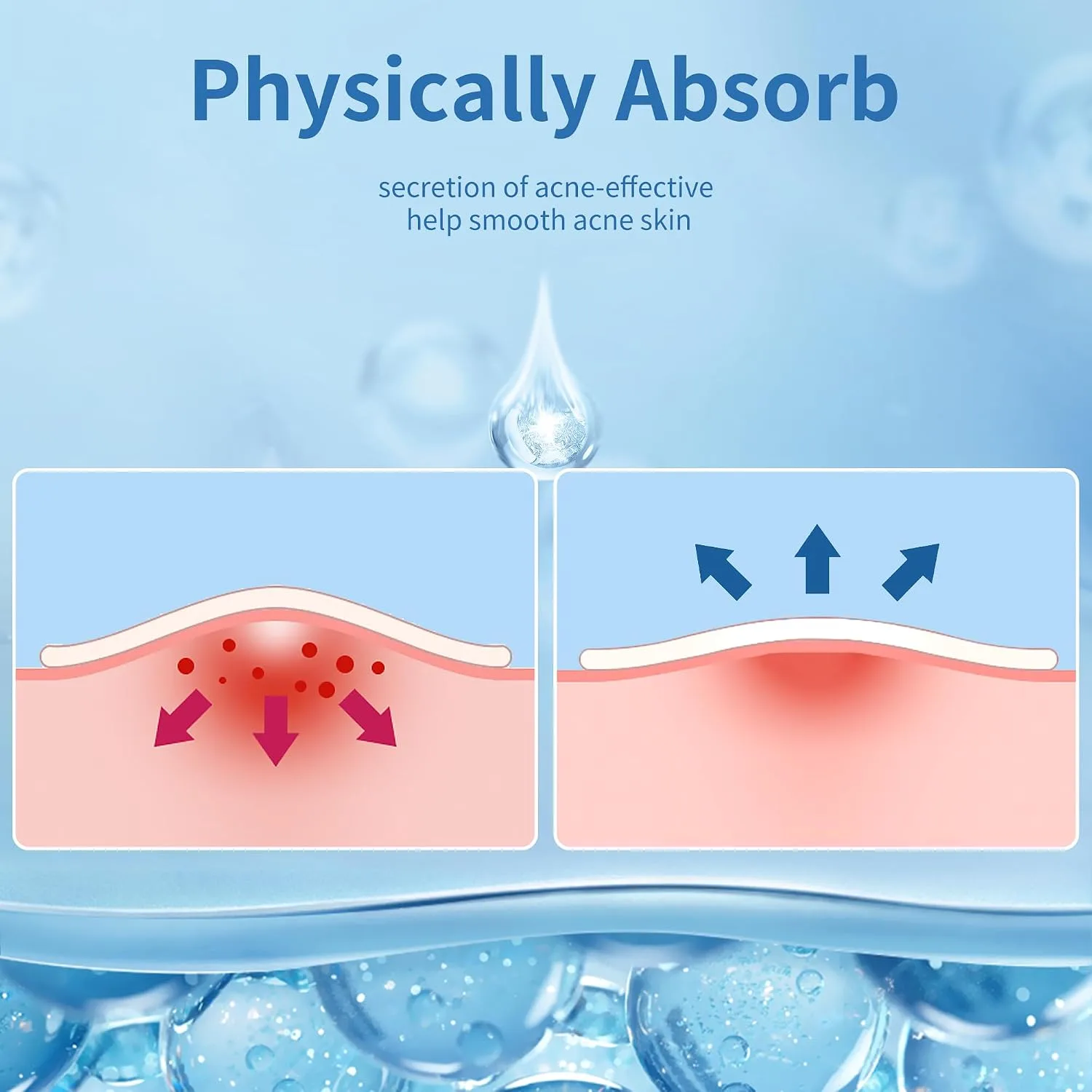 Daolyo Pimple Patches for Face, 4 Size 560 Counts Hydrocolloid Acne Patches