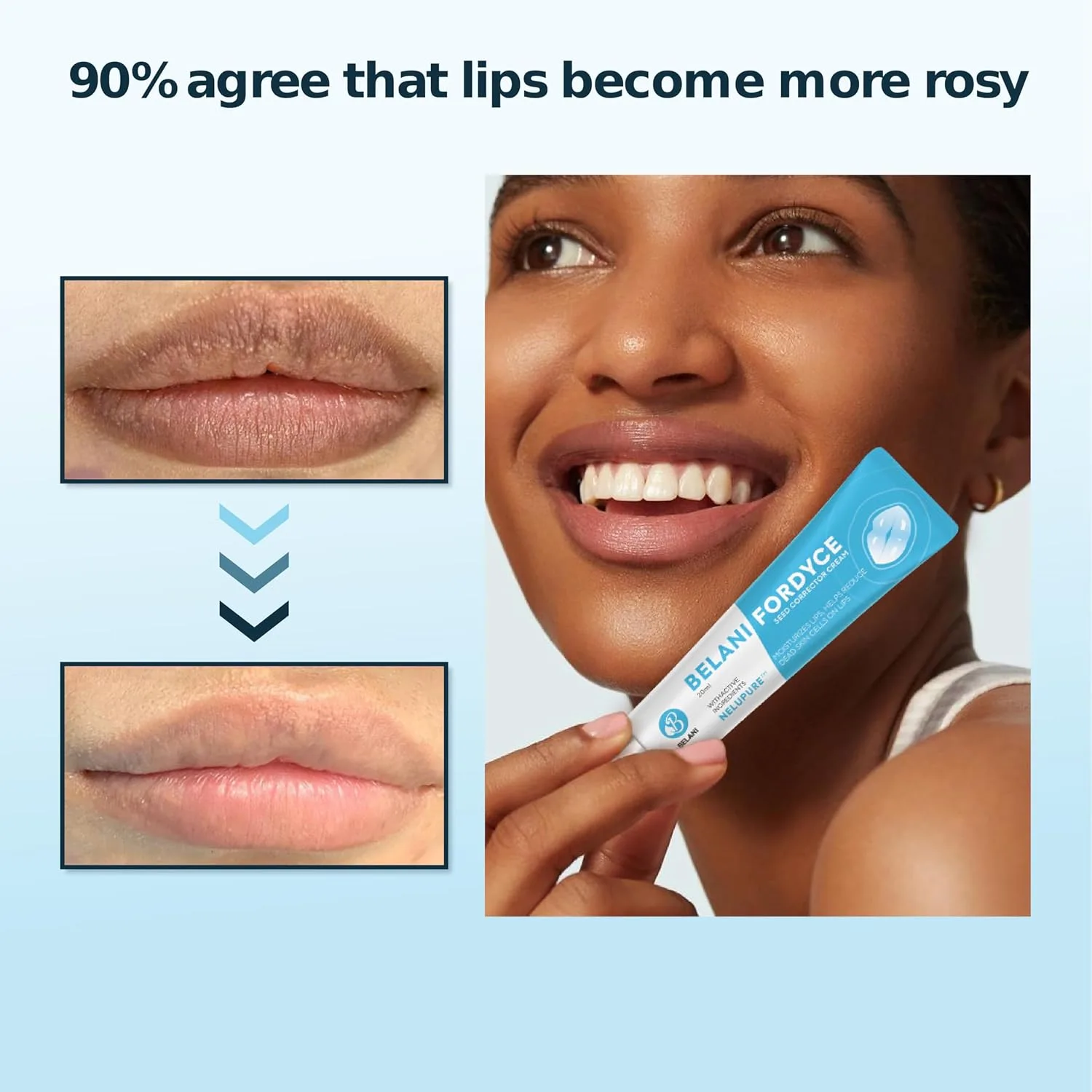 Belani Fordyce Cream - Helps Reduce Fordyce Spots, Daily Hydrating Lip Care for Dry, Chapped & Dark Sensitive Lips with Sunflower Oil, Lotus Extract & Shea Butter (0.7 Oz)