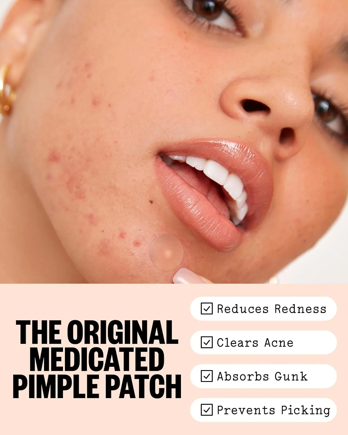 PEACE OUT Acne Healing Dots Medicated Hydrocolloid Pimple Patches (40 ct)