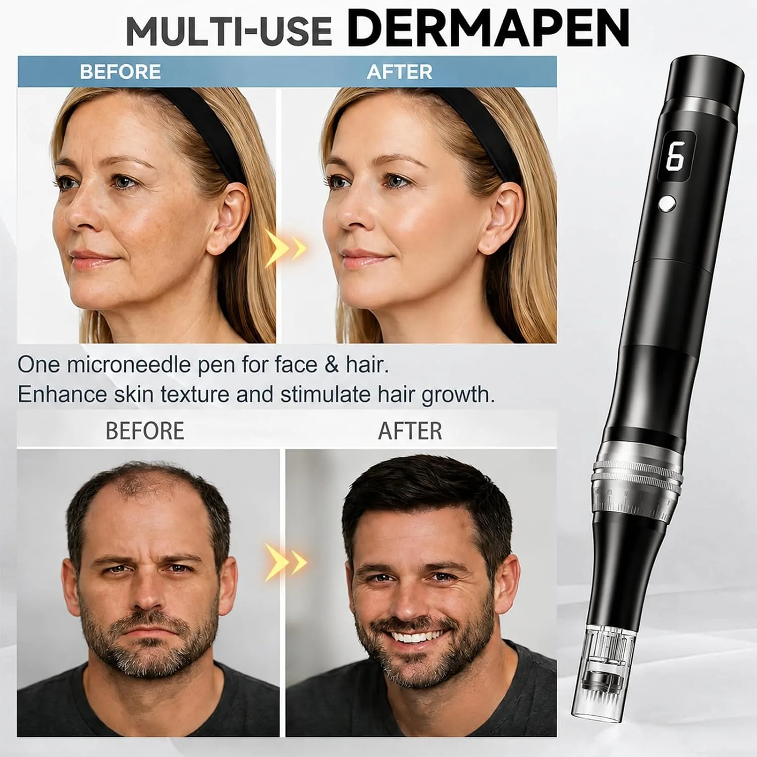 Microneedling Pen – Microneedle Derma Roller Pen for Home Use-0.25MM Black
