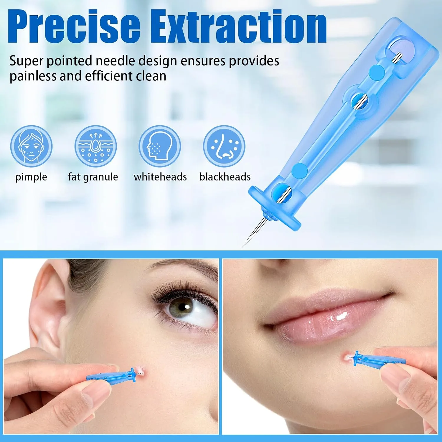 Lancets for Facial Extraction, 100Pcs Disposable Acne Needle