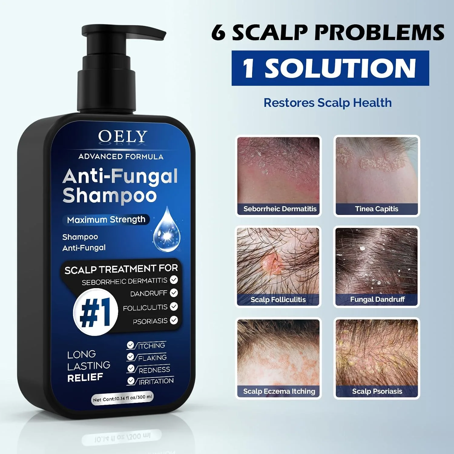 oely Antifungal Shampoo for Seborrheic Dermatitis, Folliculitis - Fresh