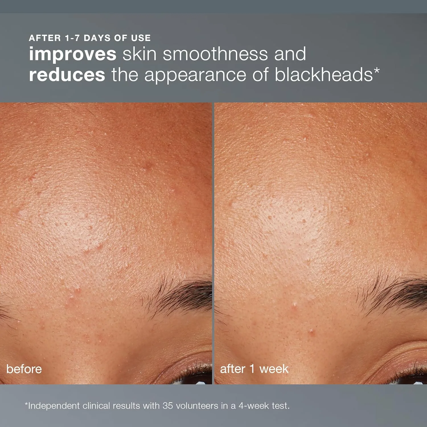 Dermalogica Daily Microfoliant, Exfoliating Face Wash for Brightening