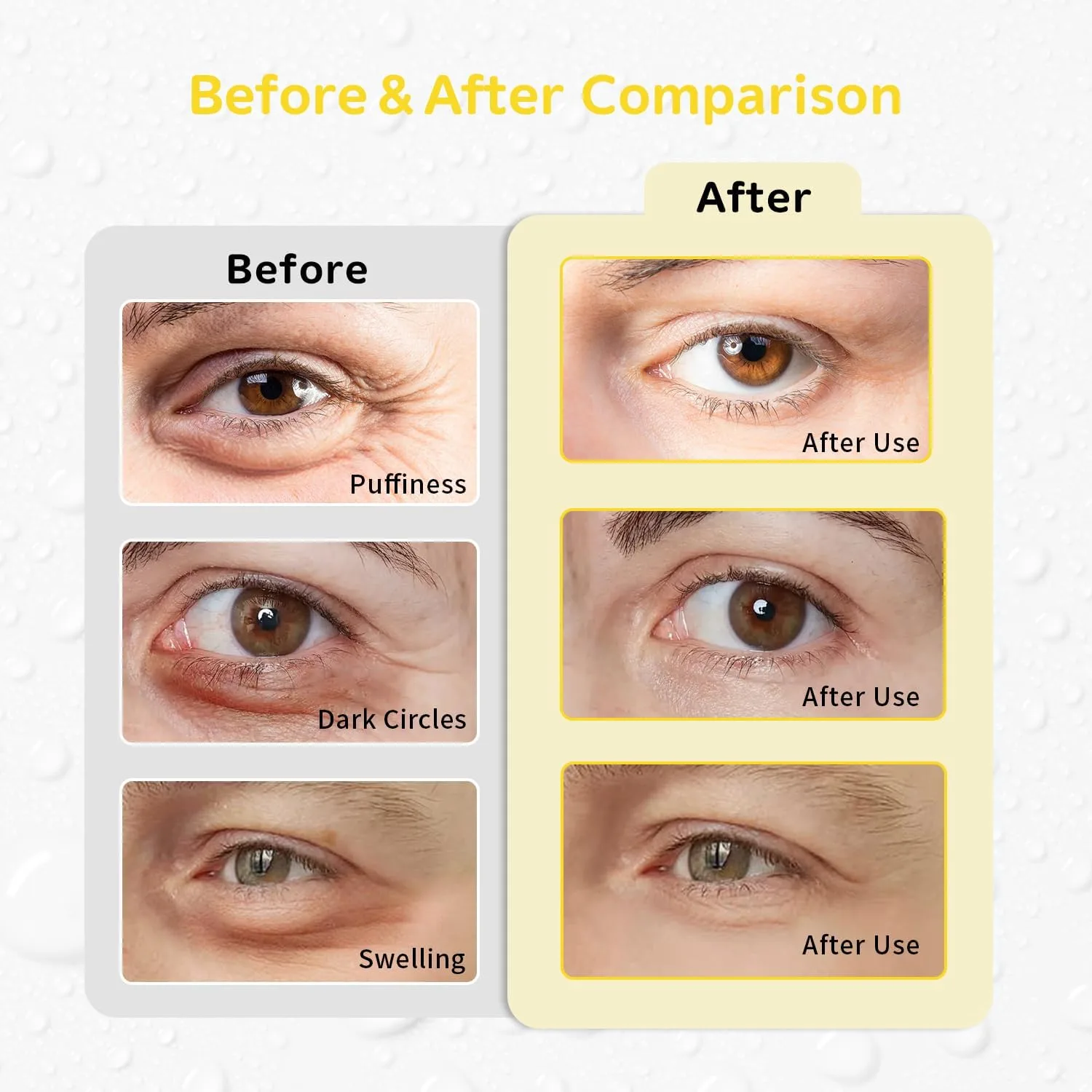 4PCS Gel Eye Ice Pack Set Reusable, Cold and Hot Compress for Eyes