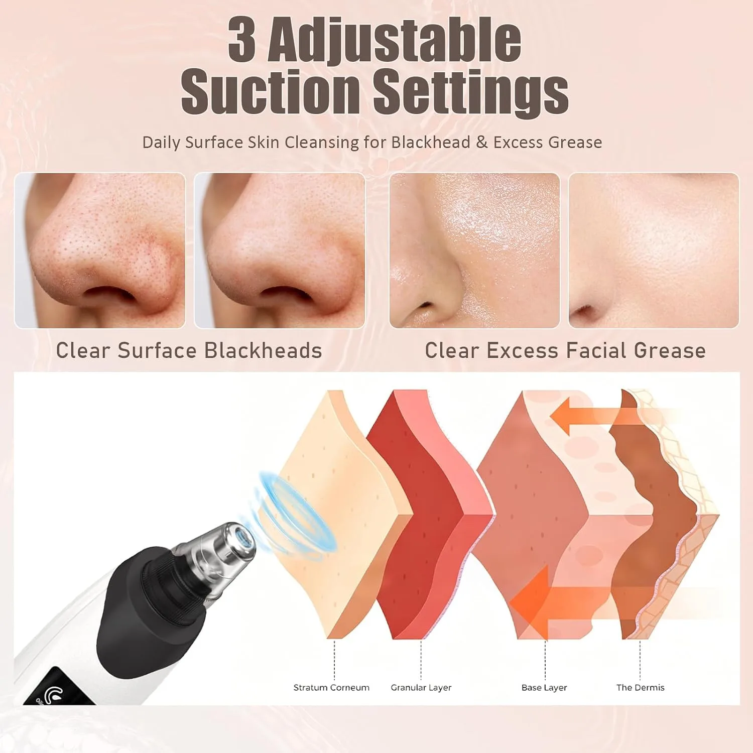 Blackhead Remover Pore Vacuum,Facial Pore Cleaner Blackhead Vacuum (Black)