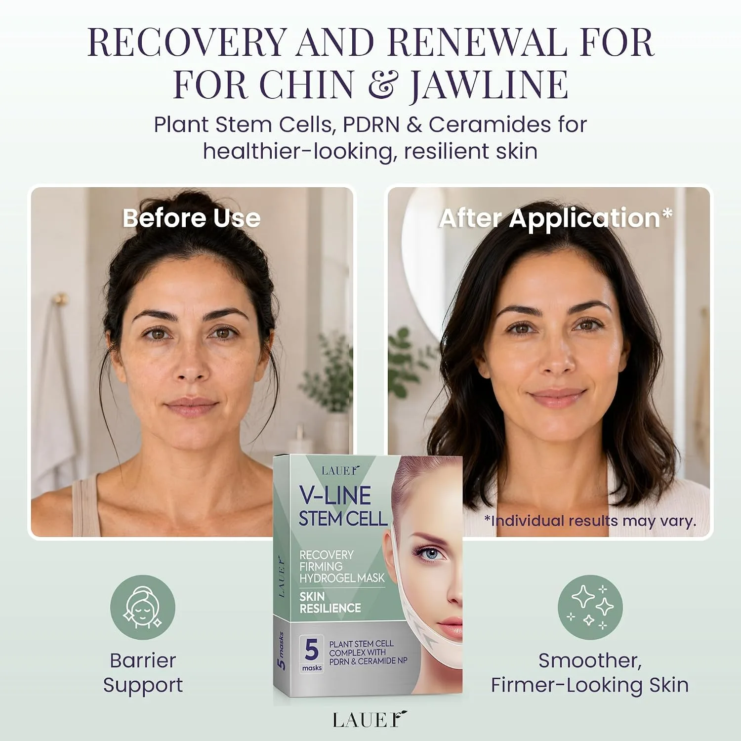 LAUER COSMETIC V-Line Stem Cell Hydrogel Mask for Chin & Jawline, 5 Count