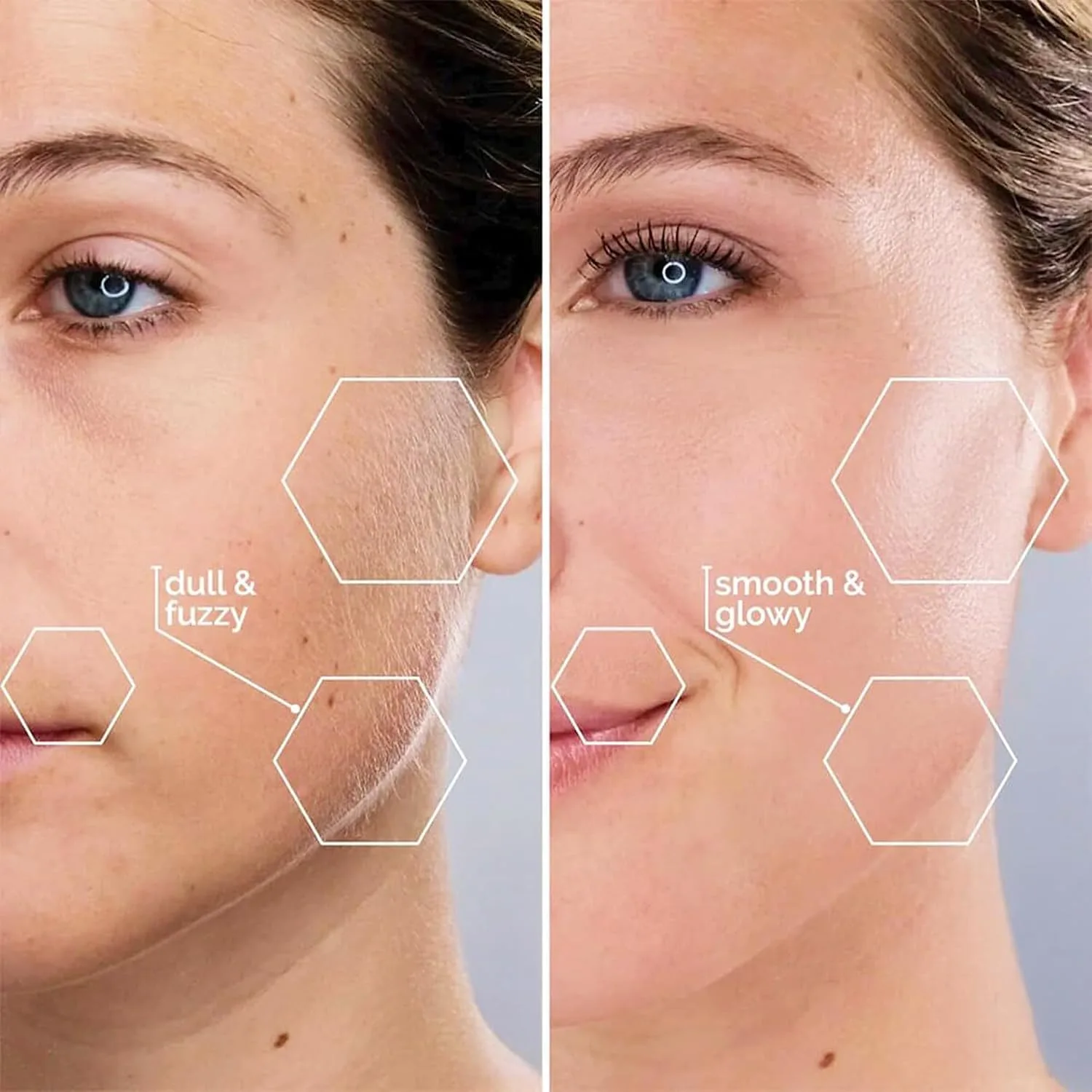 MICHAEL TODD Beauty Sonicsmooth Dermaplane Razor for Women Face