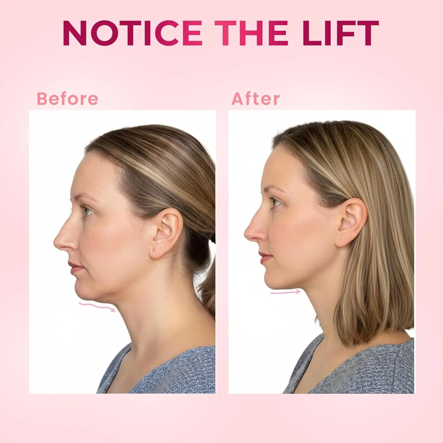 V-Line Chin Up Mask – V Shaped Face lift mask for Double Chin Reducer, Jawline Shaper Chin Strap for Sleeping Adjustable Face Slimmer for Women