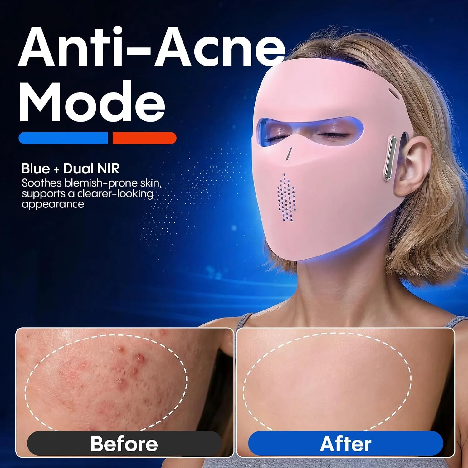 LED Face Mask with Near-Infrared, Red & Blue Light - Professional-Grade Skin Rejuvenation Device for Fine Lines, Uneven Skin Tone & Dullness