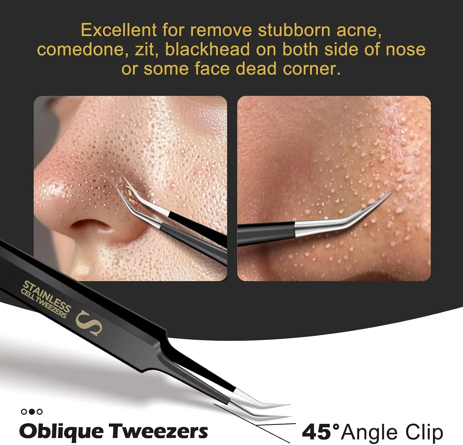 WSYUB Professional Blackhead Tweezers and Ingrown Hair Tweezers